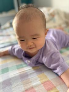 小孩有抬頭紋說明什么？身體有問題嗎