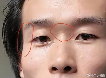 奸門凹陷面相好嗎？奸門凹陷命運運勢情況